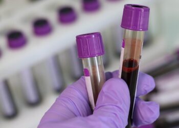 യുഎഇയിലെ കൊവിഡ് നിബന്ധനകളില്വീണ്ടും  മാറ്റം വരുത്തി