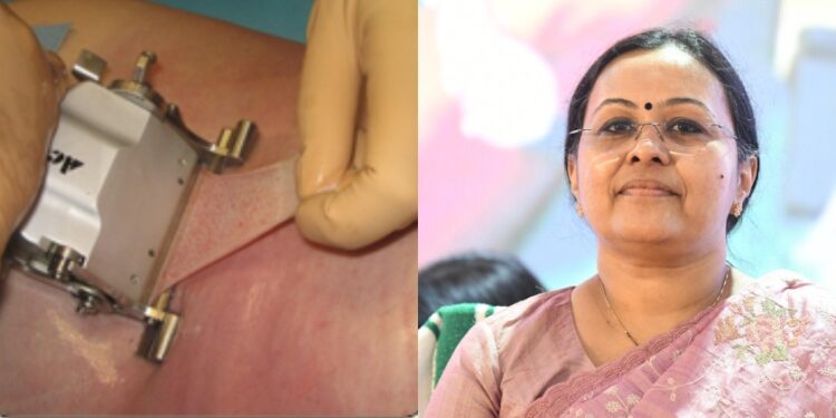 കേരളത്തില് ആദ്യമായി സ്കിന് ബാങ്ക്, പൊള്ളലേറ്റവര്ക്ക് ലോകോത്തര ചികിത്സ നൽകും’: മന്ത്രി വീണാ ജോര്ജ്